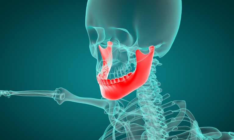 cone beam computed tomography (CBCT)