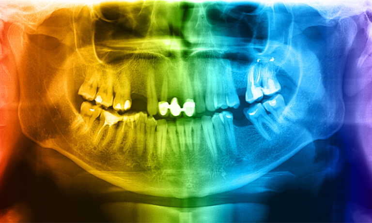 dental imaging