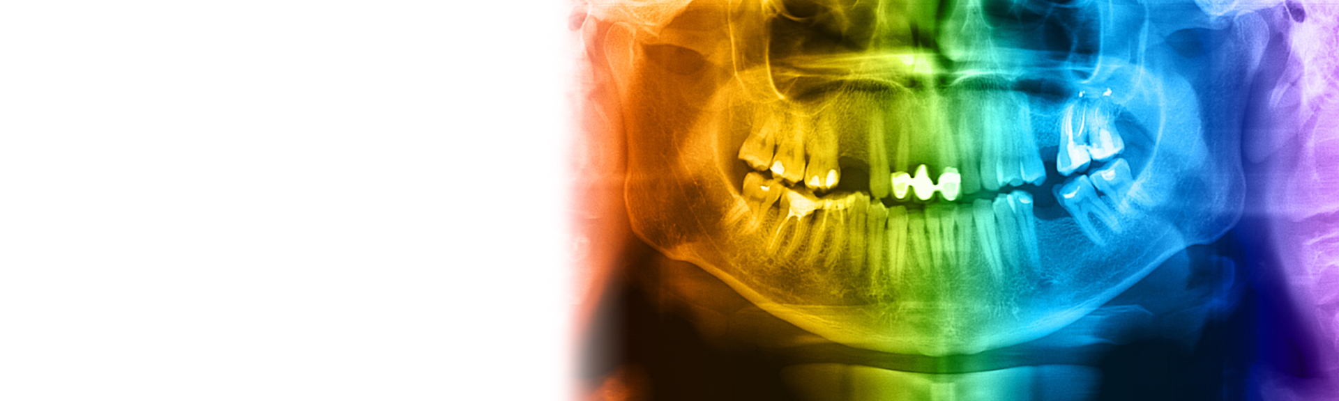 dental-imaging