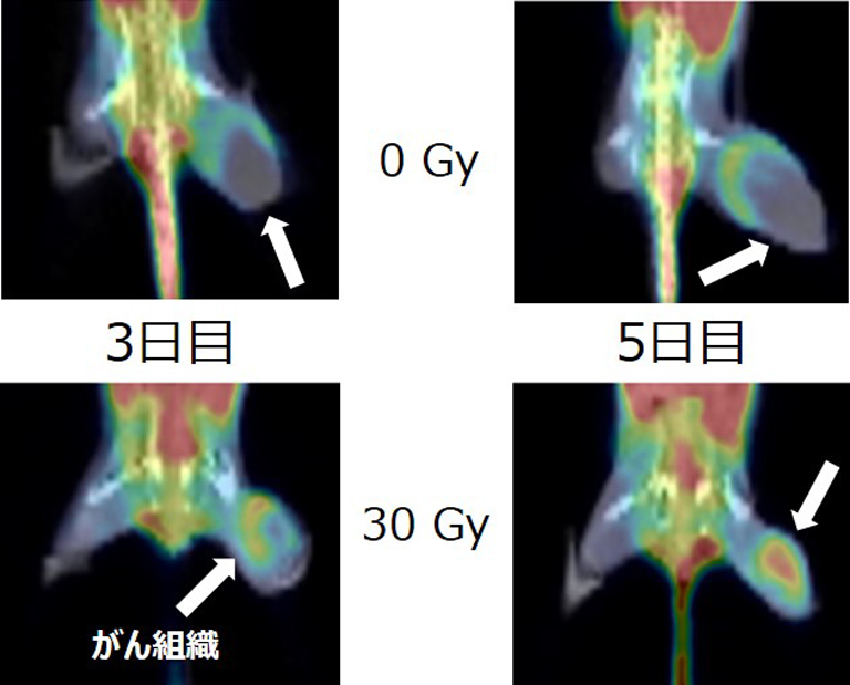 18F-BCPP-EFのPET画像