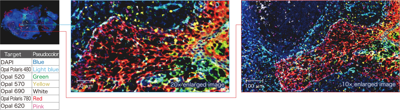 Image of Seven-plex overlay image of paraffin-embedded human tonsil sample