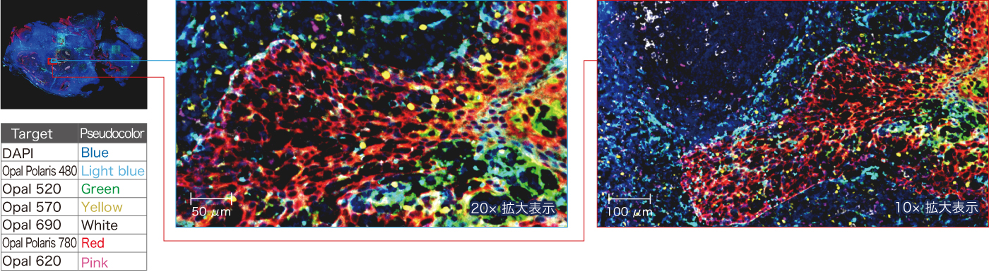 パラフィン包埋ヒト 扁桃サンプルの7プレックス重ね合わせ画像