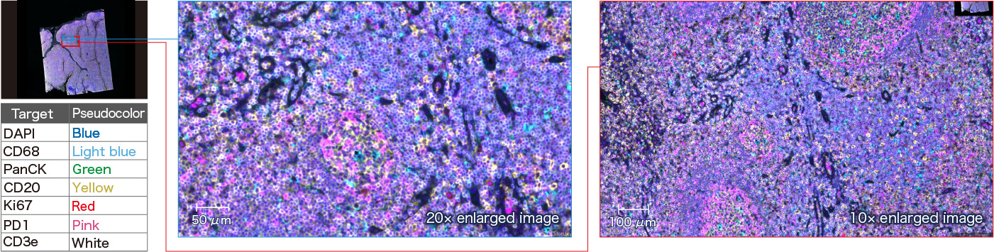 Seven-plex overlay image of paraffin-embedded human tonsil sample