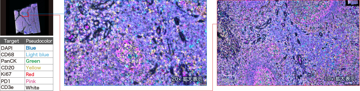パラフィン包埋ヒト扁桃サンプルの7プレックス重ね合わせ画像