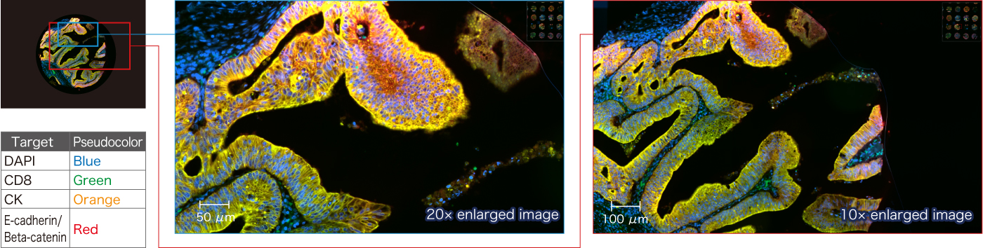 Image of Four-plex overlay image of paraffin-embedded human colon sample