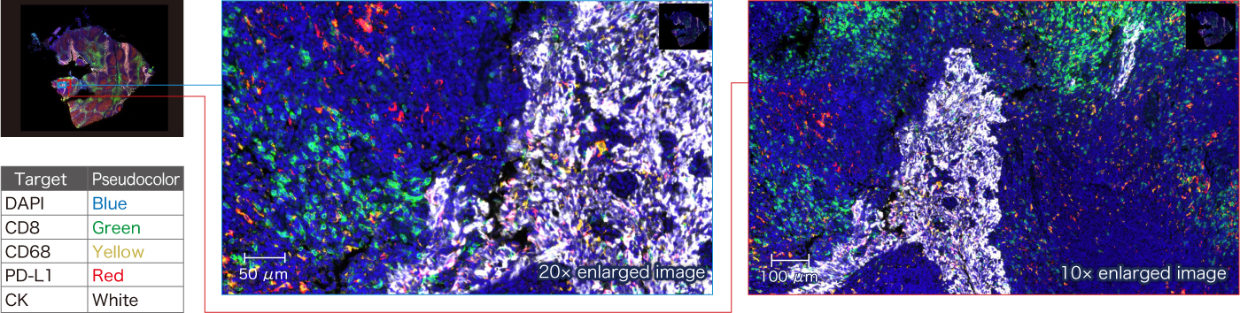 Image of Four-plex overlay image of paraffin-embedded tonsil tissue sample