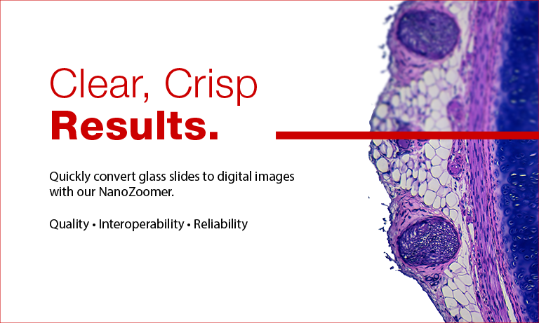 NanoZoomer, clear, crisp scans