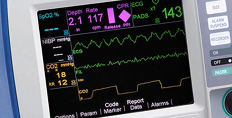 Capnography monitor