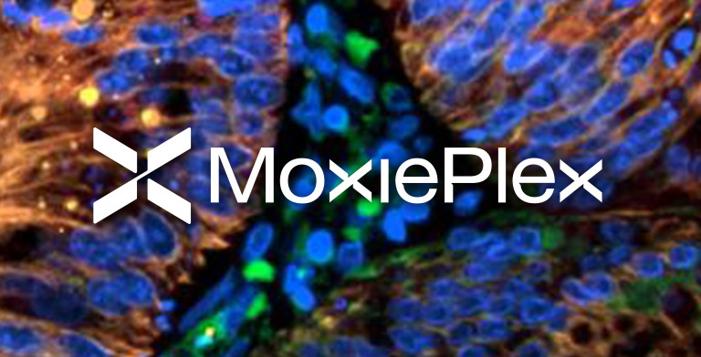 MoxiePlex