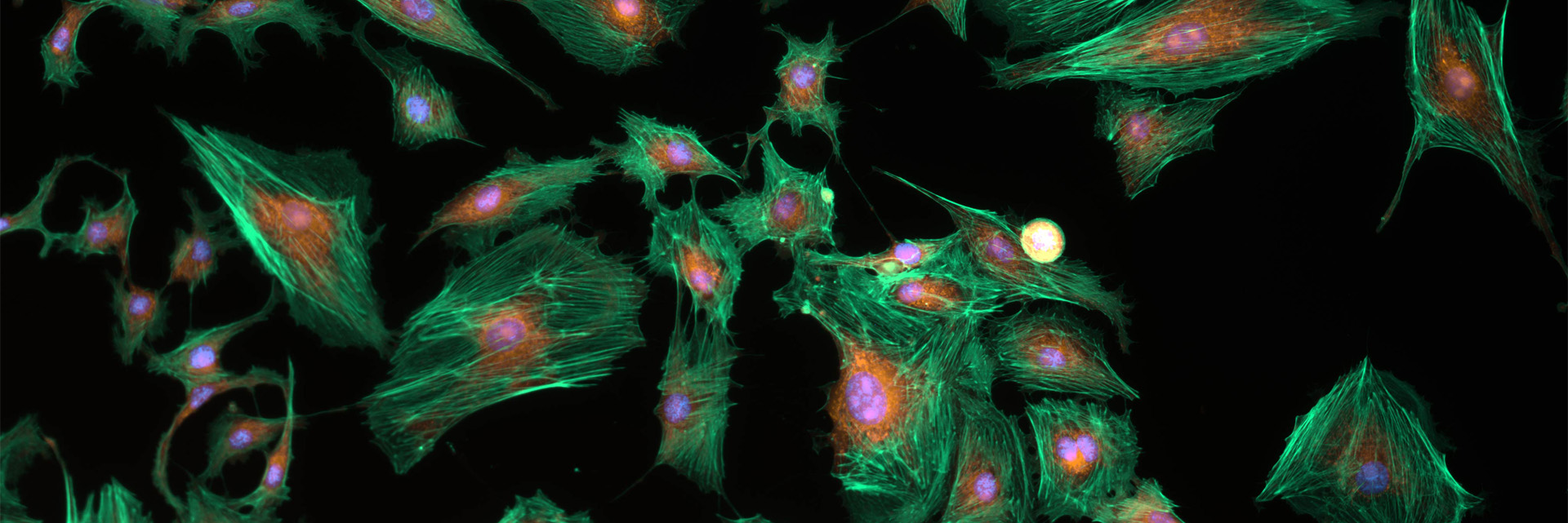 Fluorescence imaging