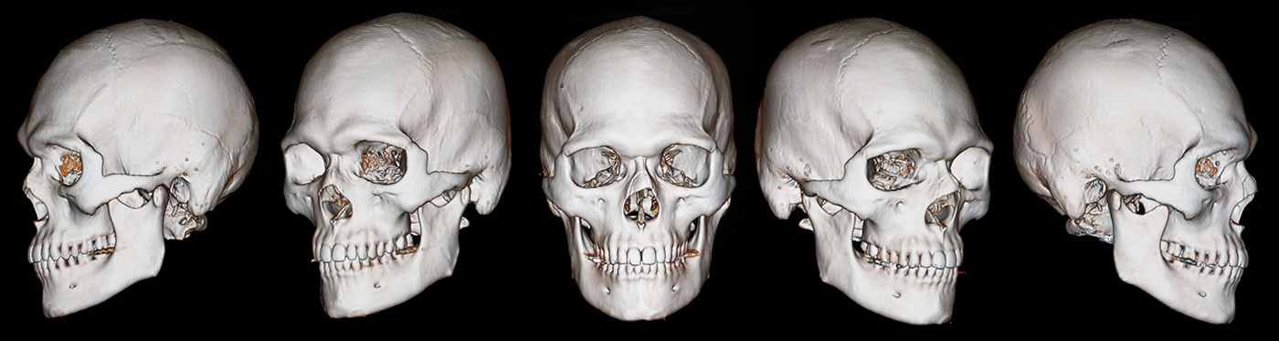 Example of dental CBCT images.