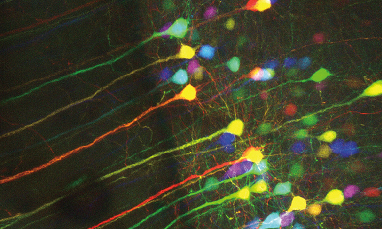 Confocal microscopy