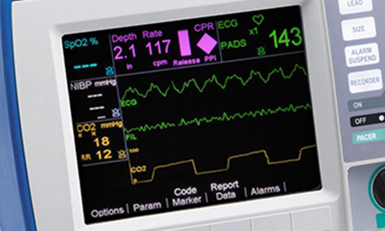 Capnography monitor