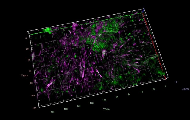 Epithelial cells stained for E-Cadherin and Actin