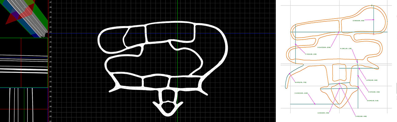 CT image of two rubber gaskets