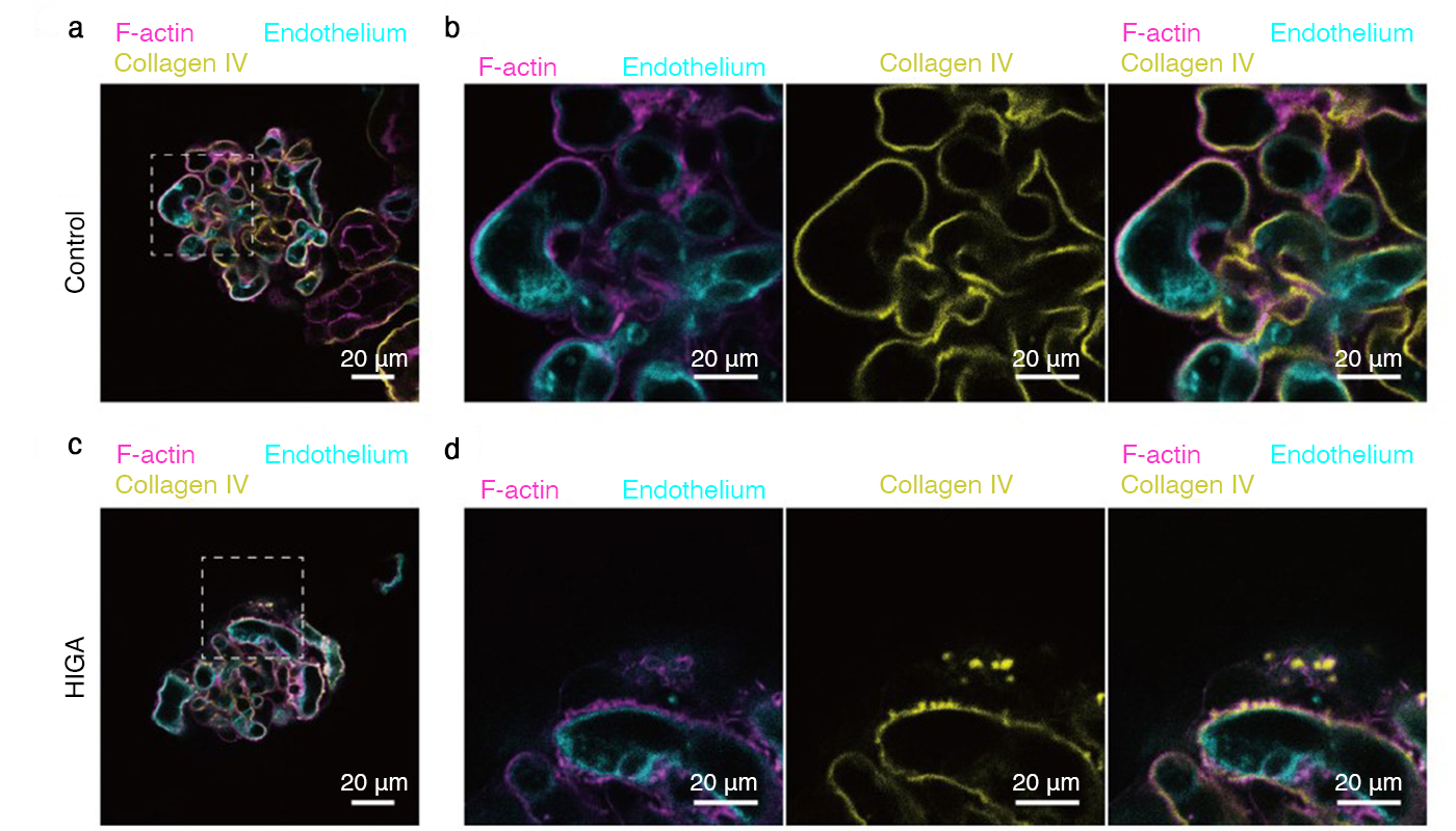 Images of the vessels in the glomerulus