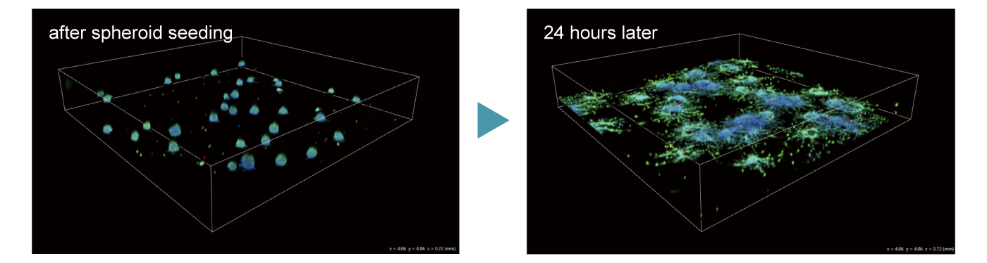 Migration/Invasion assay
