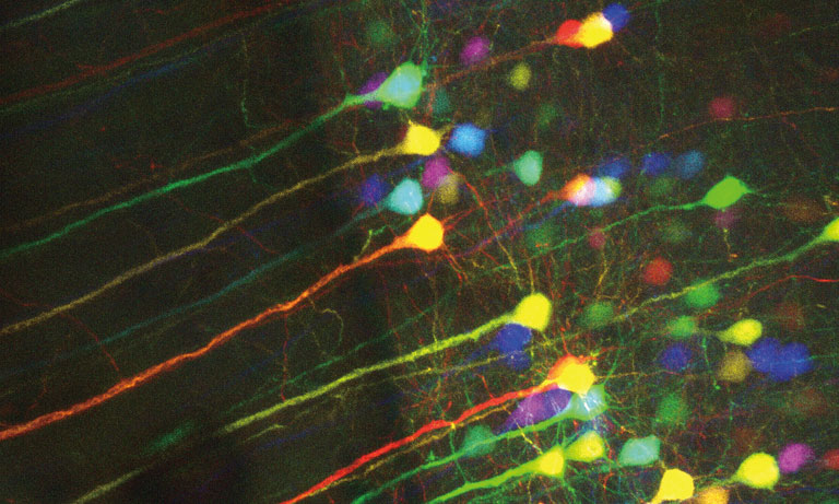 MEMS confocal unit Imaging examples