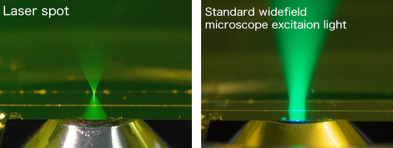Comparison image between laser excitation light and standard widefield microscope excitation light