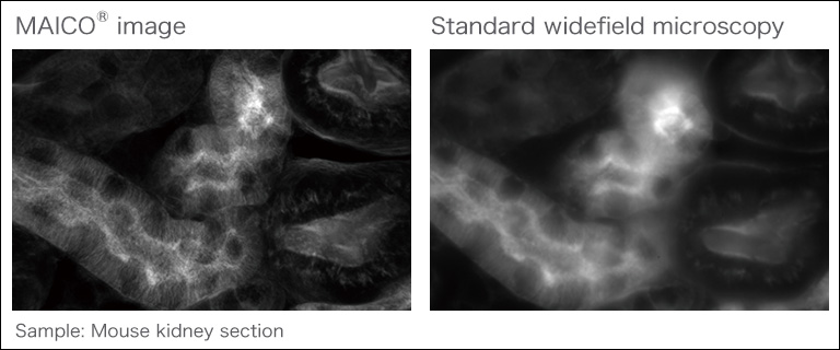 Comparison between confocal microscopy and standard widefield microscopy
