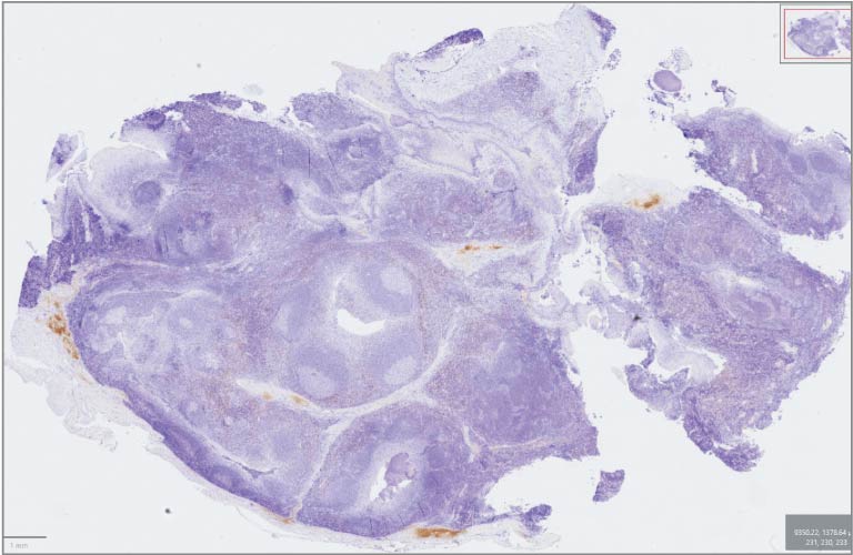 IHC