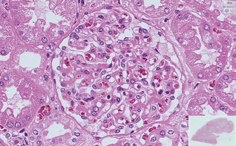 Imaging example