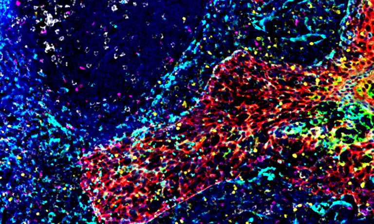 Imaging example of human tonsil