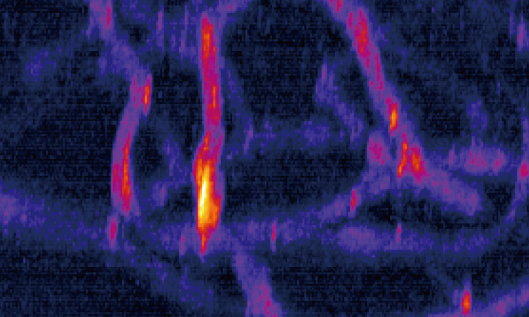 High-performance multiphoton excitation microscope using SLM