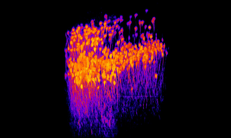Two-photon microscopic image of mouse brain neurons