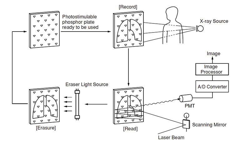 X-ray image acquisition using photostimulable phosphor plate