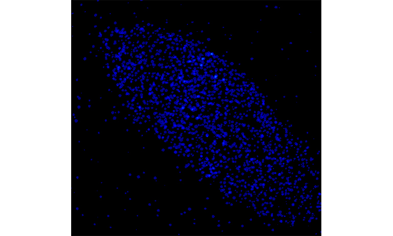 Photon counting image
