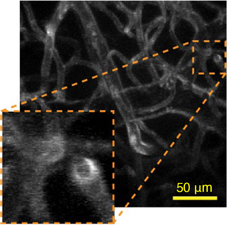 Blood vessel image applying the aberration correction method