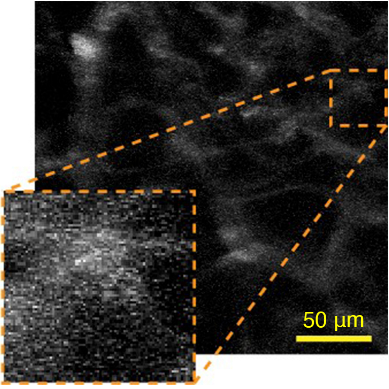 Blood vessel image with no aberration correction