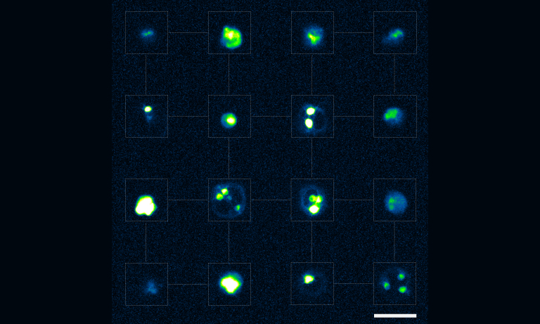 Neurons cultured in a microfluidic device