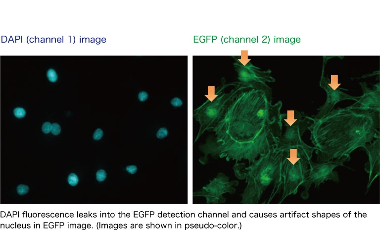 DAPI & EGFP image