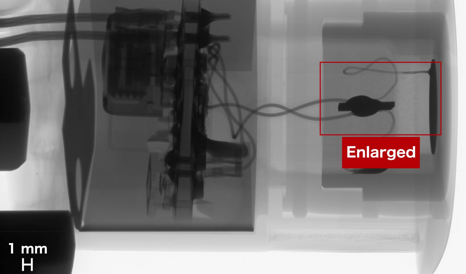 Driving support system (obstacle detection sensor)