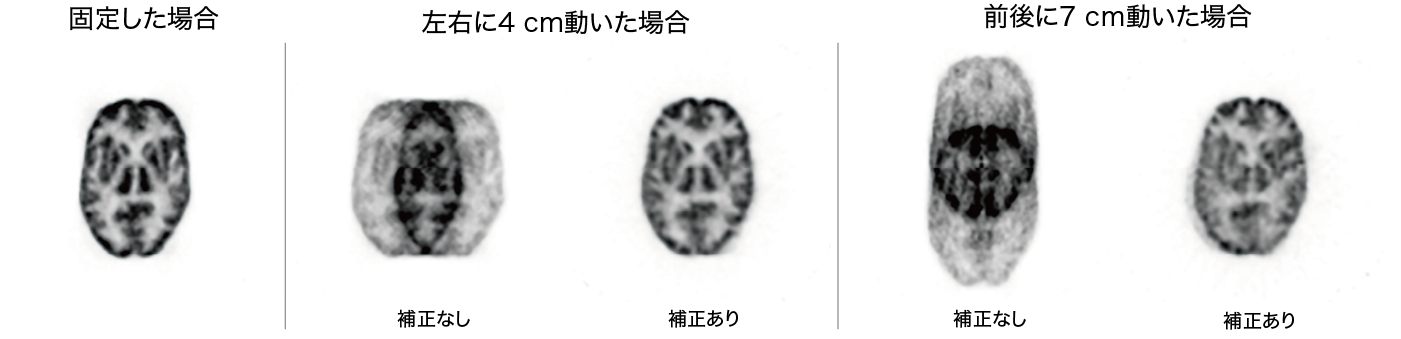 頭部用PET装置の撮像例