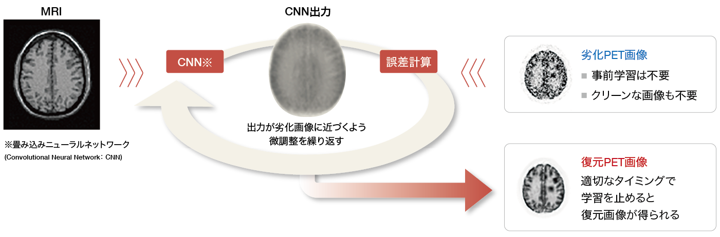 教師なしディープラーニングによるPET画像ノイズ除去
