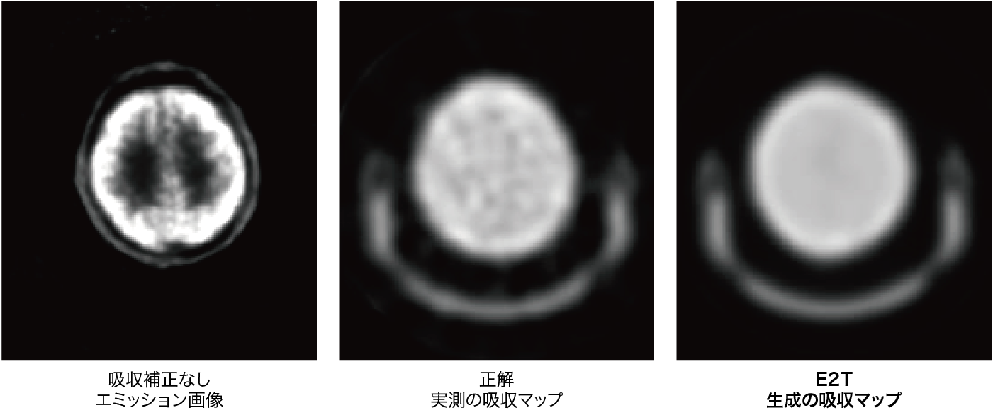 FDG (糖代謝)の結果