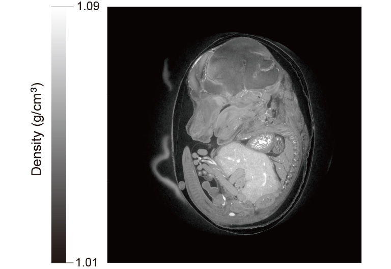 マウス胎仔のX線位相CT像