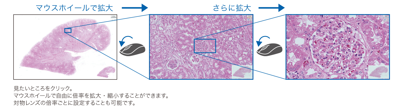 バーチャルスライドの拡大