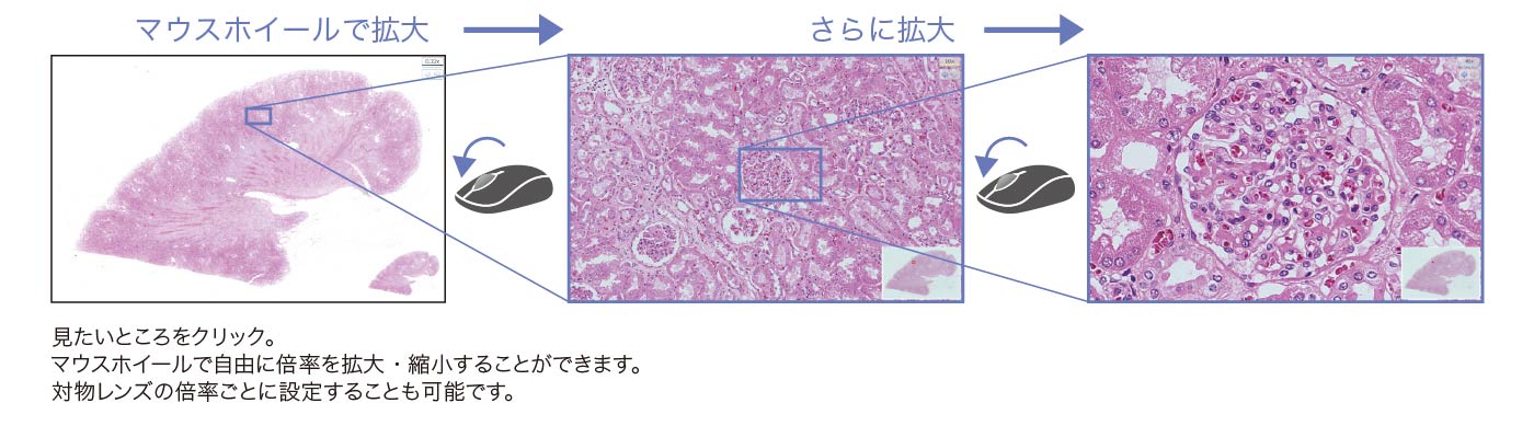 バーチャルスライドの拡大