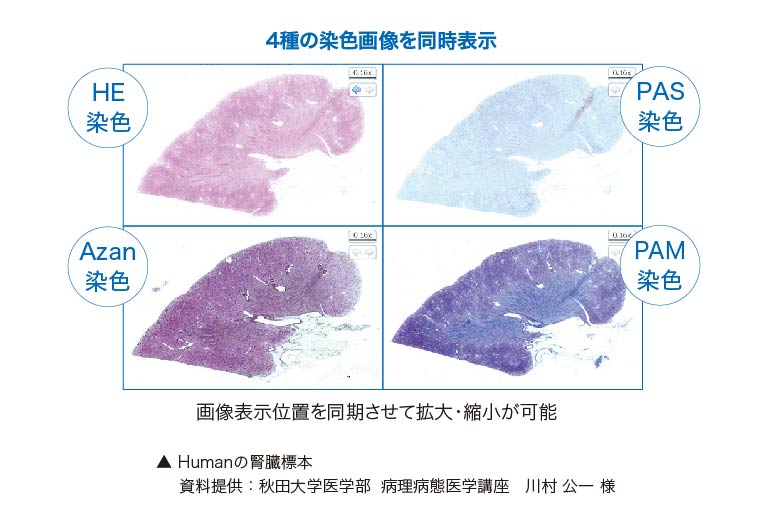 腎臓標本のマルチビュー表示