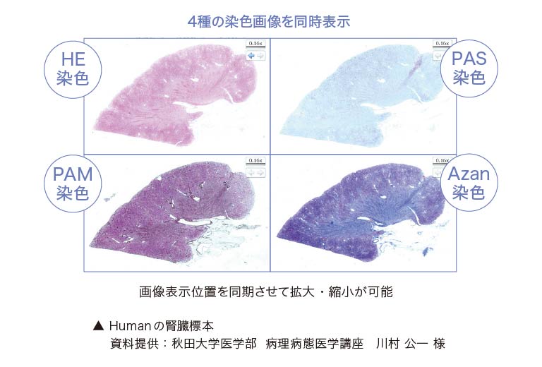 腎臓標本のマルチビュー表示
