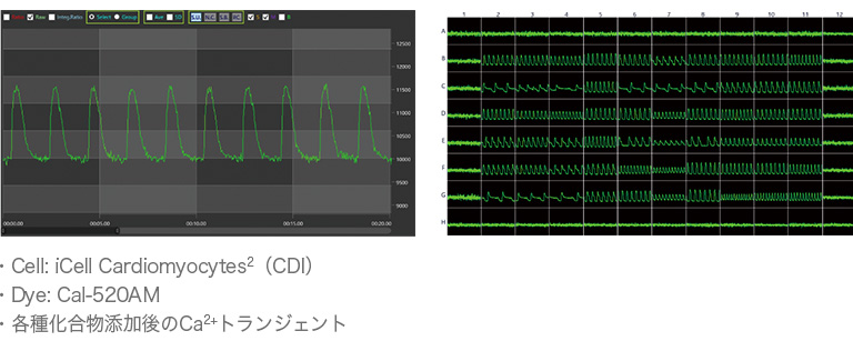 iPS細胞由来心筋細胞のCa2+トランジェント