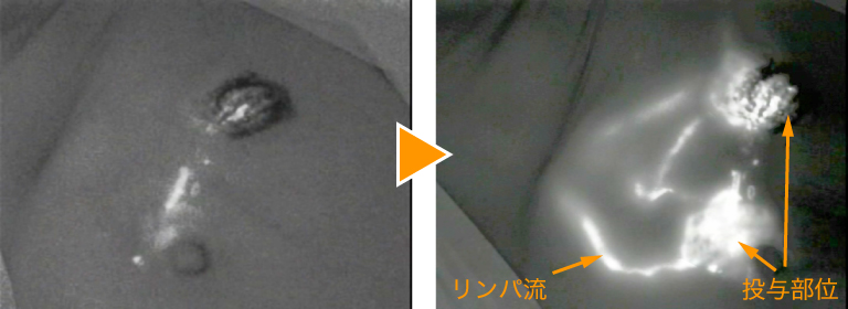 症例紹介