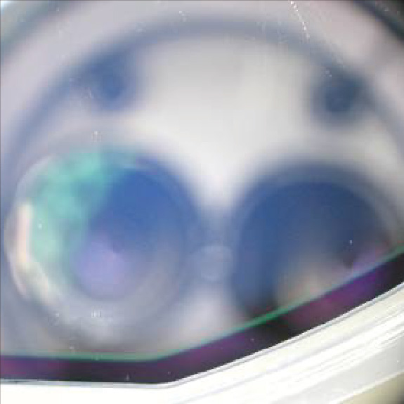 ウェーハのスペースリキッド残渣　洗浄後