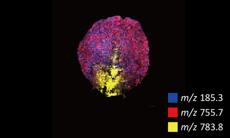 花のイメージング