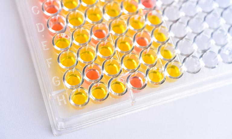 血液検査（免疫検査）