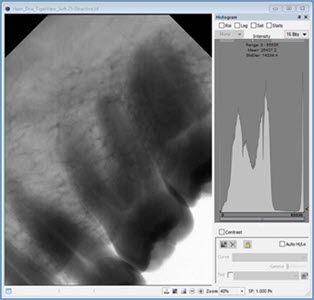 Example of intraoral DR image using Hamamatsu CMOS sensor